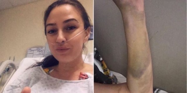 Woman says birth control pills led to ‘massive’ blood clots that nearly killed her: ‘I’m lucky to be alive’